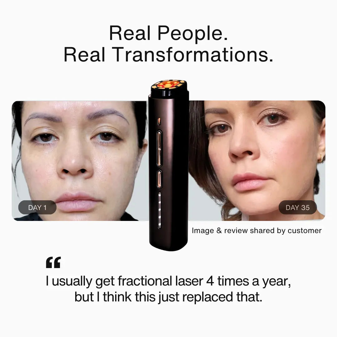 theBeam Renew Frequency®